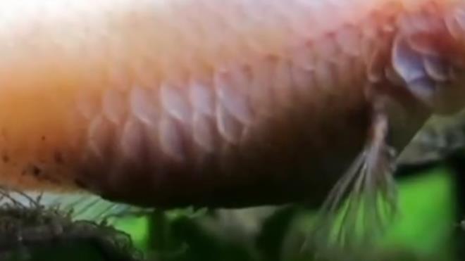 鱼竖鳞病是什么原因？得了鱼竖鳞病怎么治？一文读懂